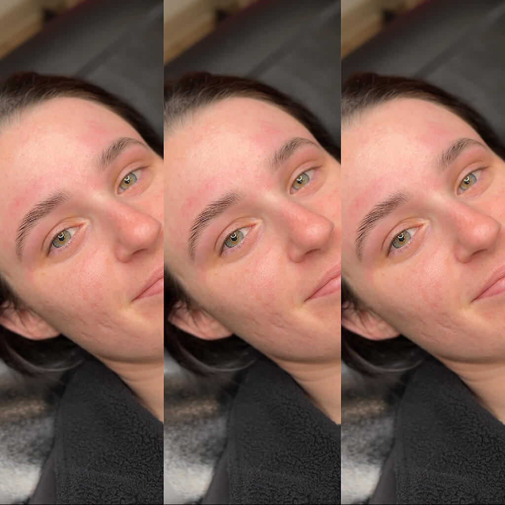 eyebrow enhancement buffalo ny